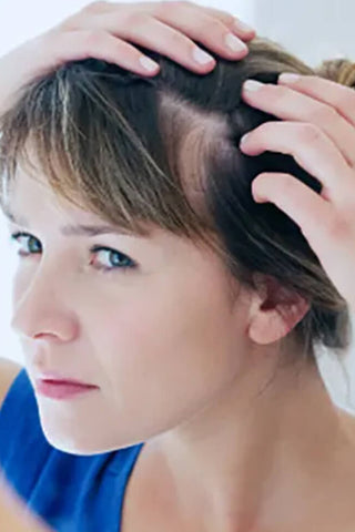 CÓMO TRATAR LA PSORIASIS DEL CUERO CABELLUDO