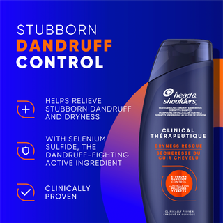 Stubborn Dandruff Control