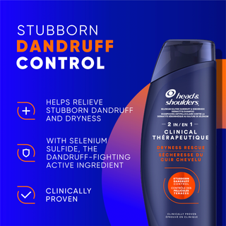 Stubborn Dandruff Control