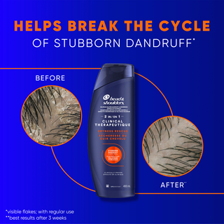 Breaks the Cycle