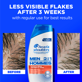 Less Visible Flakes After 3 Weeks