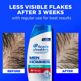 Less Visible Flakes After 3 Weeks