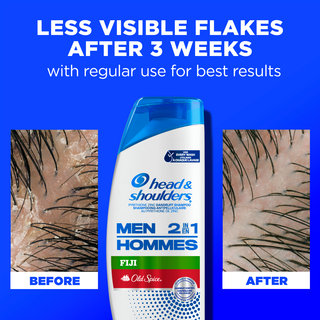 Less Visible Flakes After 3 Weeks