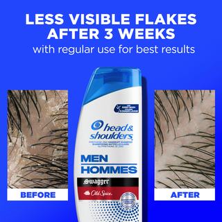 Less Visible Flakes After 3 Weeks