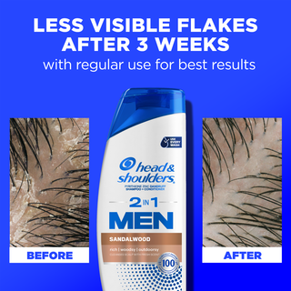 Mens 2 in 1 Dandruff Shampoo and Conditioner, Sandalwood