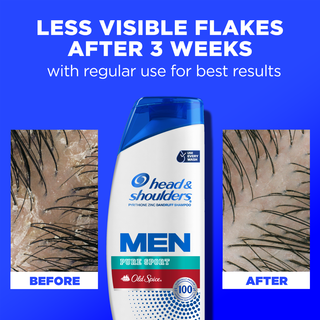 Mens Dandruff Shampoo, Old Spice Pure Sport