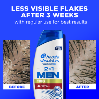 Mens 2 in 1 Dandruff Shampoo and Conditioner, Old Spice Timber