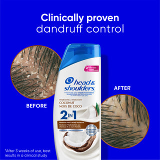 Hydrating Coconut 2 in 1 Dandruff Shampoo and Conditioner