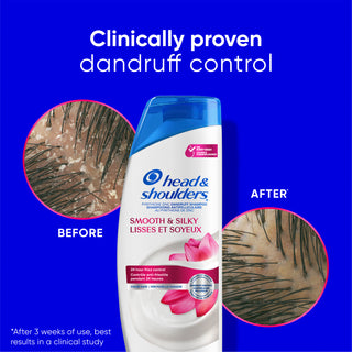 Smooth & Silky Dandruff Shampoo, Frizz Control