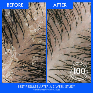 Best Results After A 3  Week Study