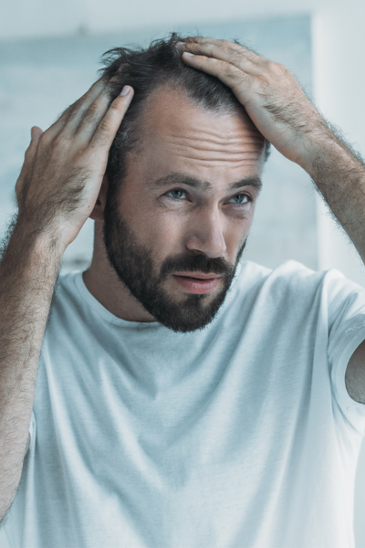 HOW DOES MINOXIDIL WORK FOR HAIR LOSS?