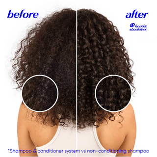Deep Moisture Dandruff Conditioner, Shea Butter, Zinc Pyrithione