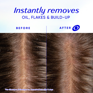 Head & Shoulders Scalp Purify Anti-Dandruff Clarify Pre-Shampoo, Salicylic Acid
