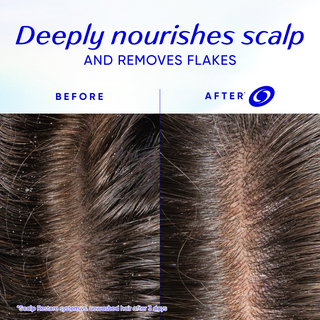 Head & Shoulders Scalp Restore Anti-Dandruff Nourishing Shampoo
