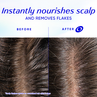 Head & Shoulders Scalp Restore Anti-Dandruff Leave-On Serum, Boosts Scalp Moisture