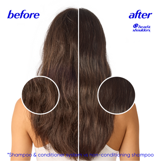 Dry Scalp Care Anti-Dandruff Conditioner for Daily Use, Paraben Free