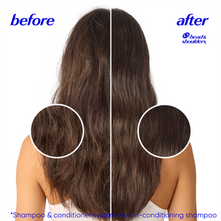 Head & Shoulders 2 in 1 Nourish & Shine Dandruff Shampoo and Conditioner