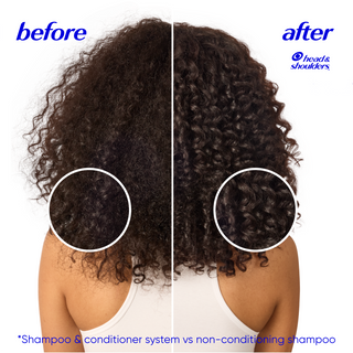 Coconut Dandruff Conditioner