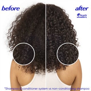 Head & Shoulders 2 in 1 Nourish & Shine Dandruff Shampoo and Conditioner