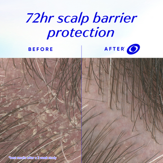 Head & Shoulders Scalp Soothe Anti-Dandruff Cooling Shampoo
