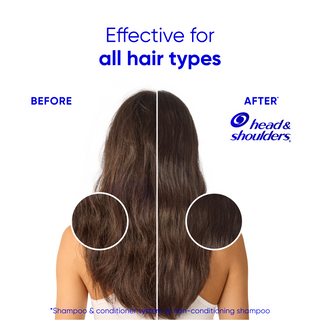 Coconut 2 in 1 Dandruff Shampoo and Conditioner