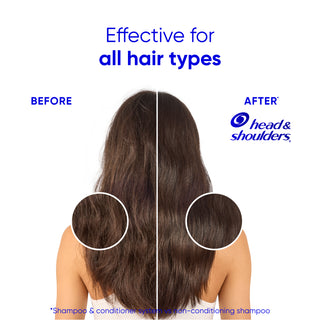 Smooth & Silky Dandruff Conditioner, Frizz Control