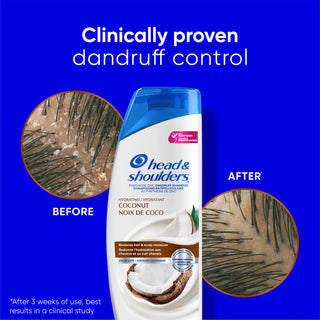 Coconut Dandruff Shampoo