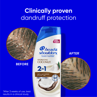Coconut 2 in 1 Dandruff Shampoo and Conditioner