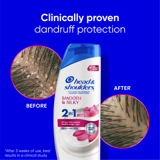 Smooth & Silky 2 in 1 Dandruff Shampoo and Conditioner