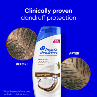Coconut Dandruff Shampoo