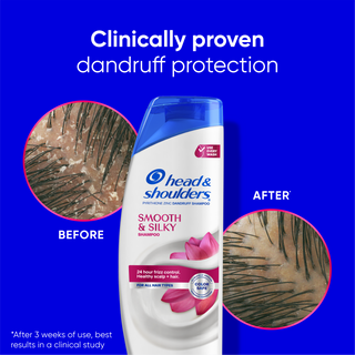 Smooth & Silky Dandruff Shampoo
