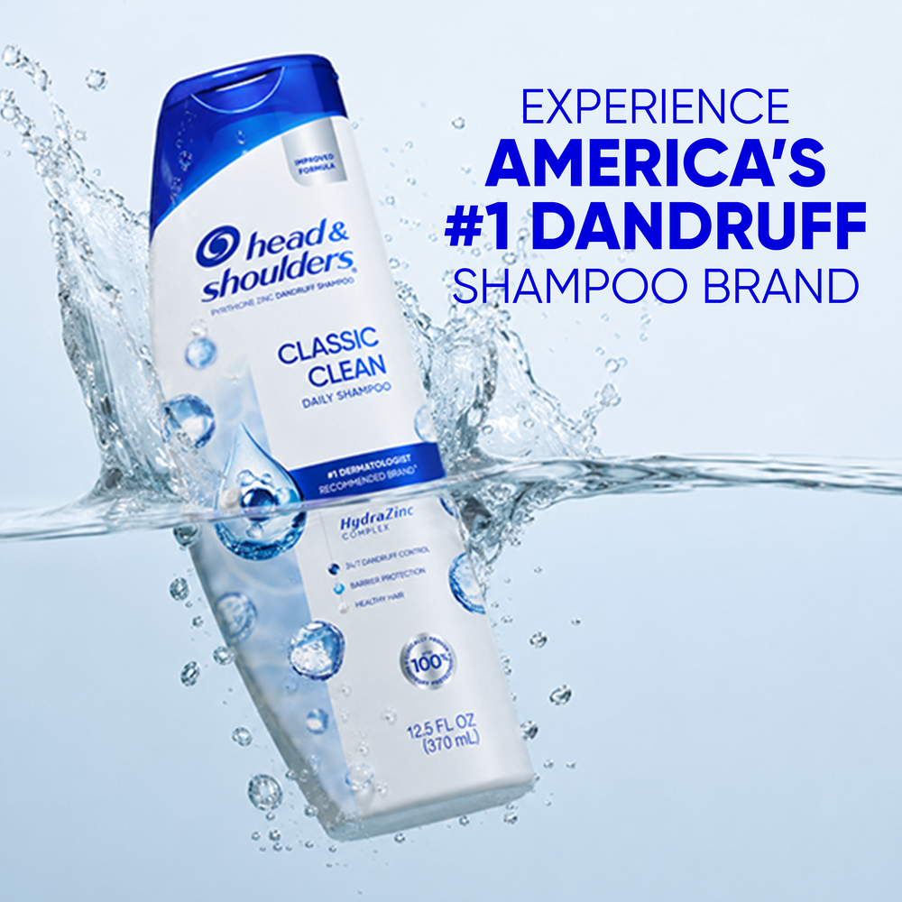 Cómo Detectar Los Síntomas De La Dermatitis Seborreica – Head & Shoulders