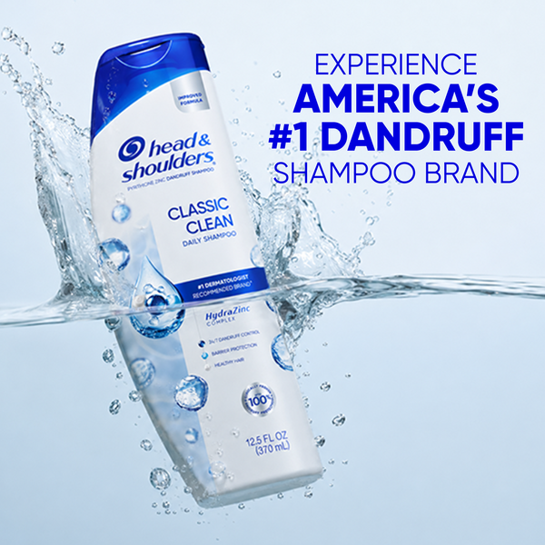 Cómo Detectar Los Síntomas De La Dermatitis Seborreica – Head & Shoulders