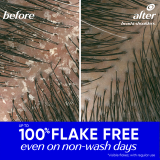 Head & Shoulders Green Apple 2 IN 1 Anti-Dandruff Shampoo & Conditioner, with Zinc Pyrithione
