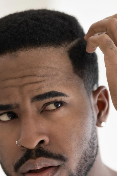 How to Identify the Different Types of Dandruff